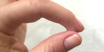 Cum se curata super glue de pe maini, plastic, haine, metal sau sticla 8 super glue piele
